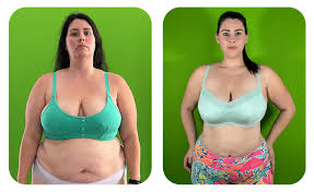 what is the best injection for weight loss